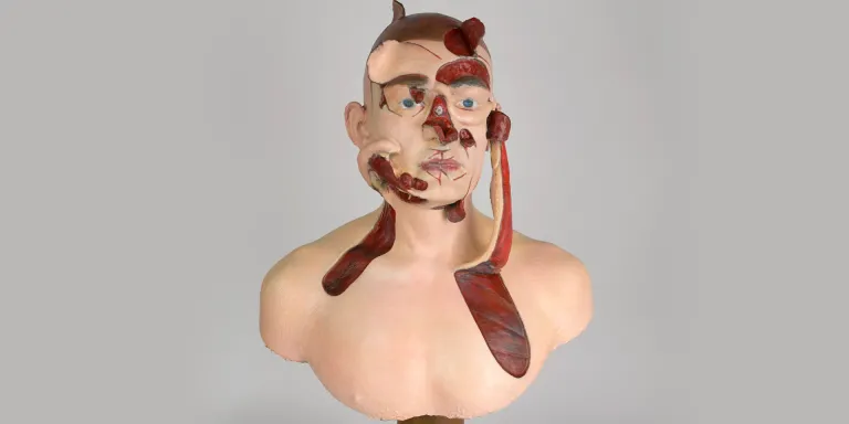 Facsimile of a wax teaching model demonstrating facial reconstruction methods