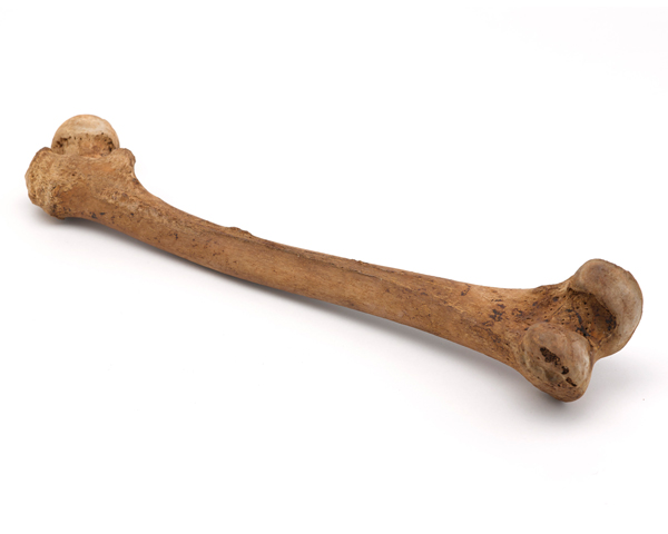 Leg bone of Lieutenant John Fraser, wounded during the Siege of Gibraltar, 1782