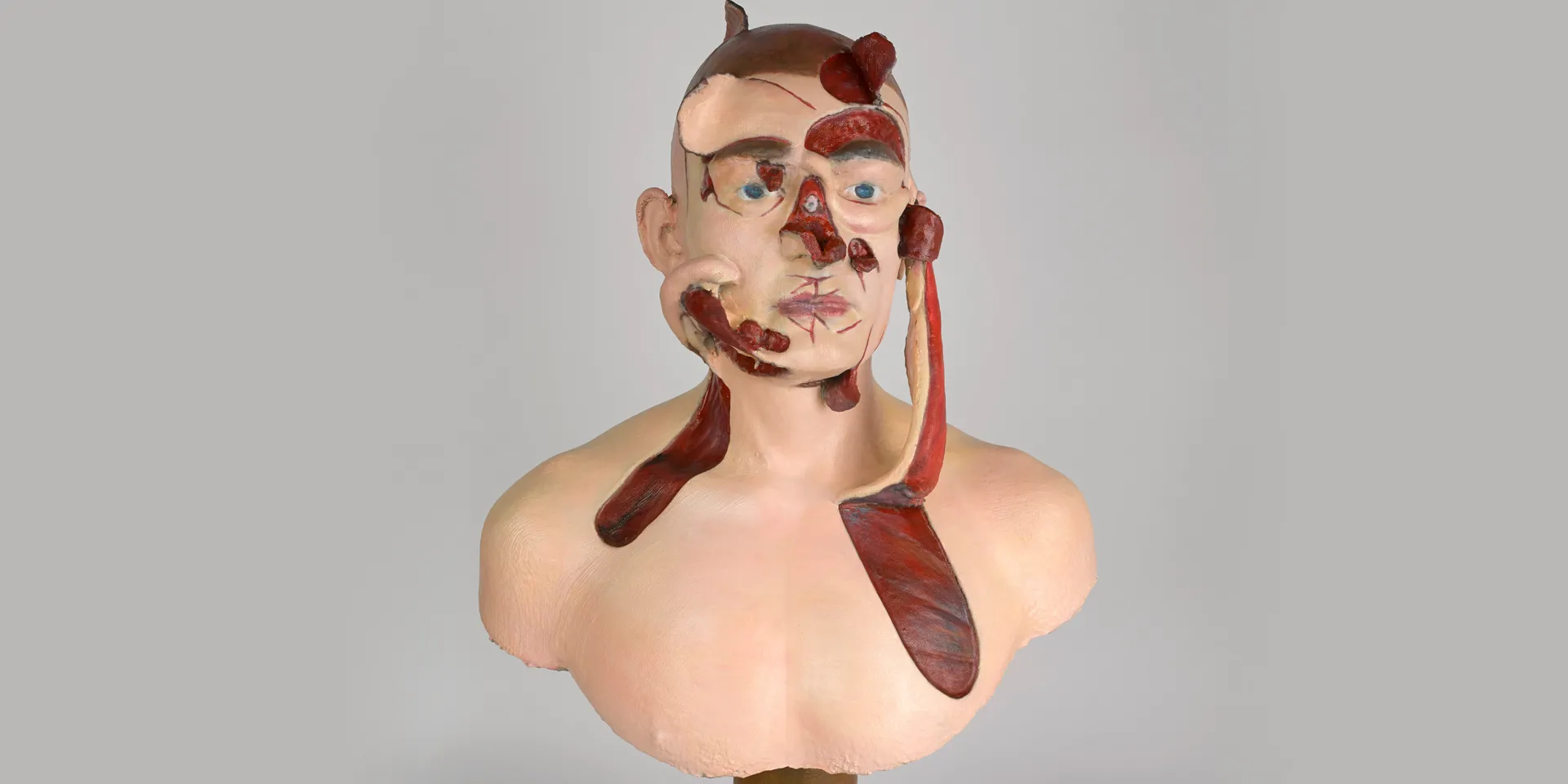 The birth of plastic surgery | National Army Museum