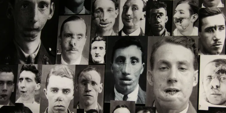 Collage of First World War facial injuries